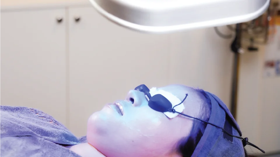 Công nghệ trẻ hóa, mờ nếp nhăn secret rf