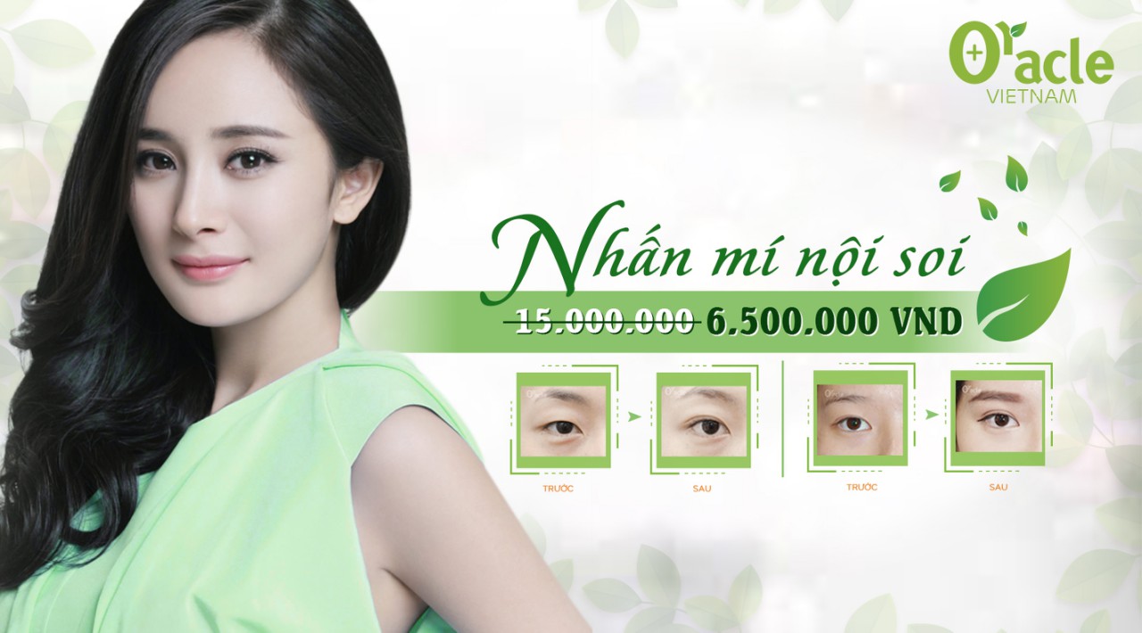 Nhấn mí nội khoa không phẫu thuật