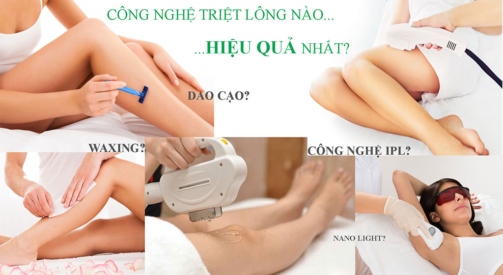 triệt lông