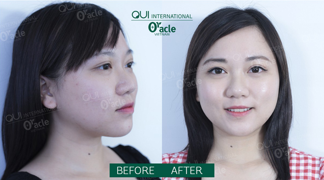 Bio-Whitening – “vắc-xin” phòng ngừa lão hóa sớm cho da - 3