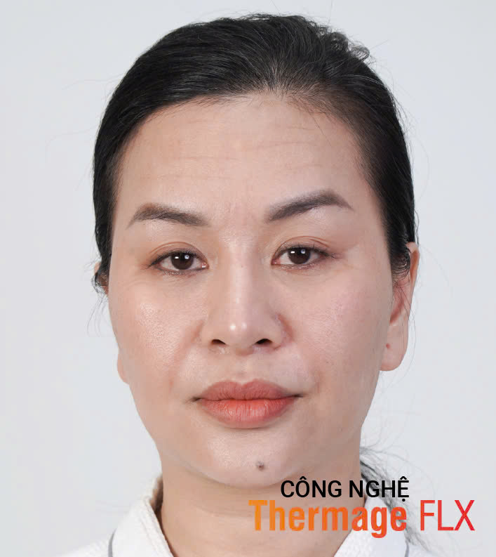 Hinh-anh-khach-hang-truoc-sau-1