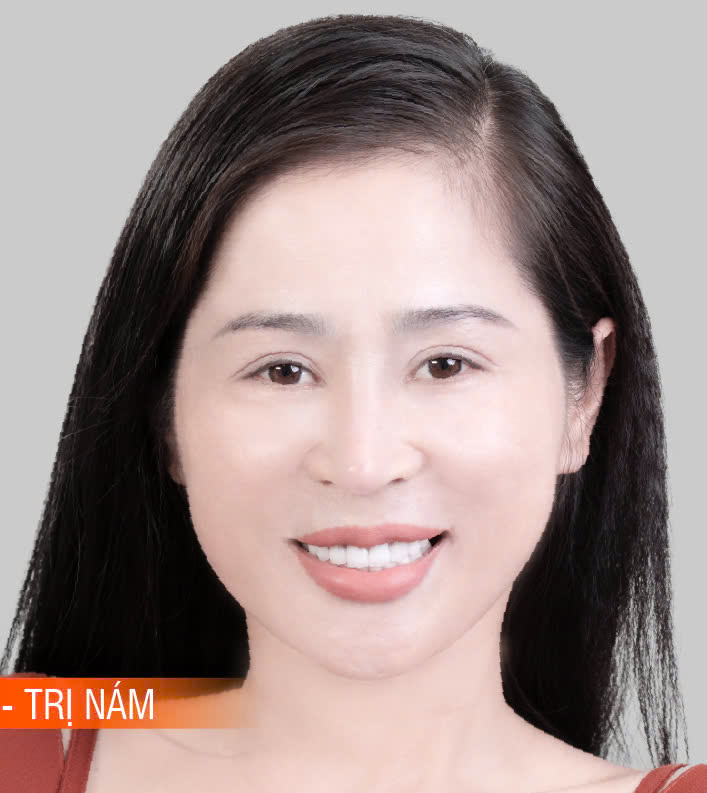 Hinh-anh-khach-hang-truoc-sau-4