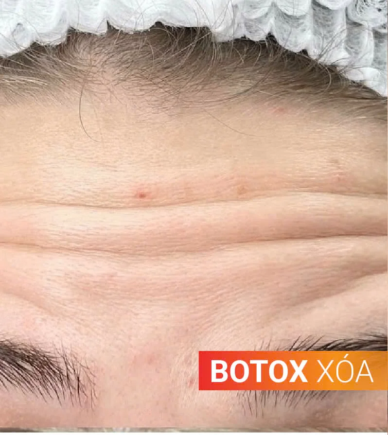 Hinh-anh-khach-hang-truoc-sau-5