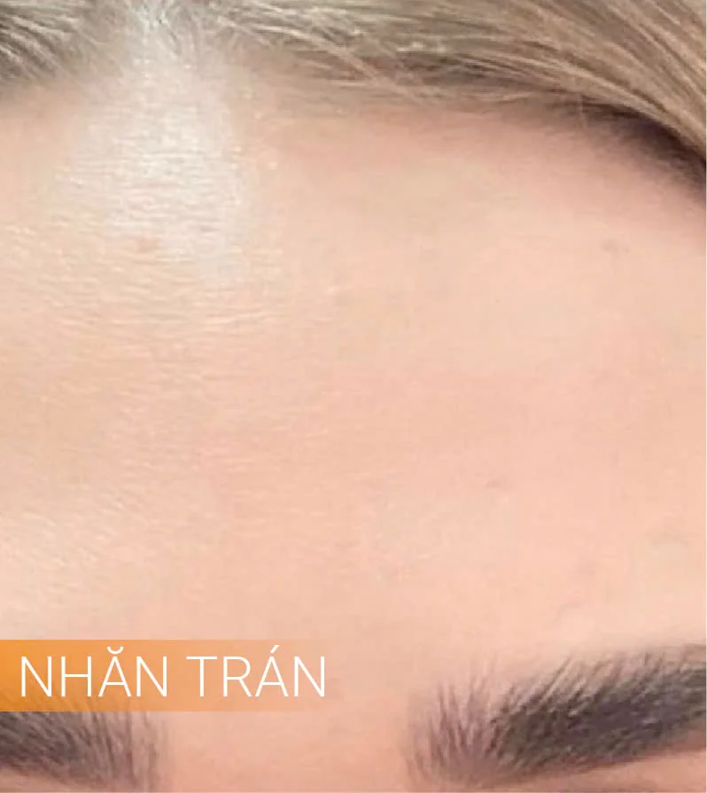 Hinh-anh-khach-hang-truoc-sau-6