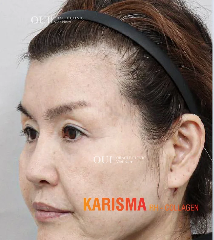 Hinh-anh-khach-hang-truoc-sau-7