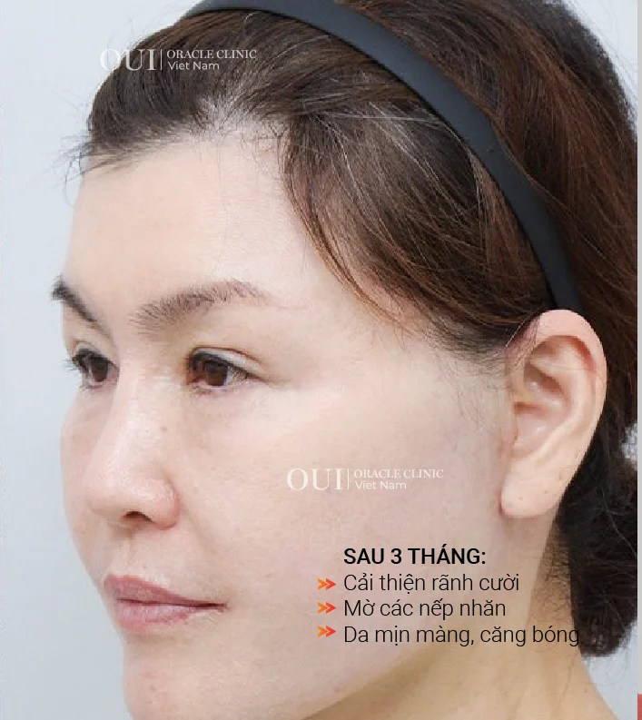 Hinh-anh-khach-hang-truoc-sau-8