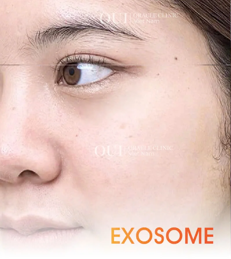 Hinh-anh-khach-hang-truoc-sau-9