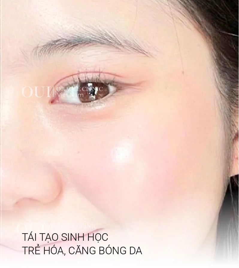 Hinh-anh-khach-hang-truoc-sau-10