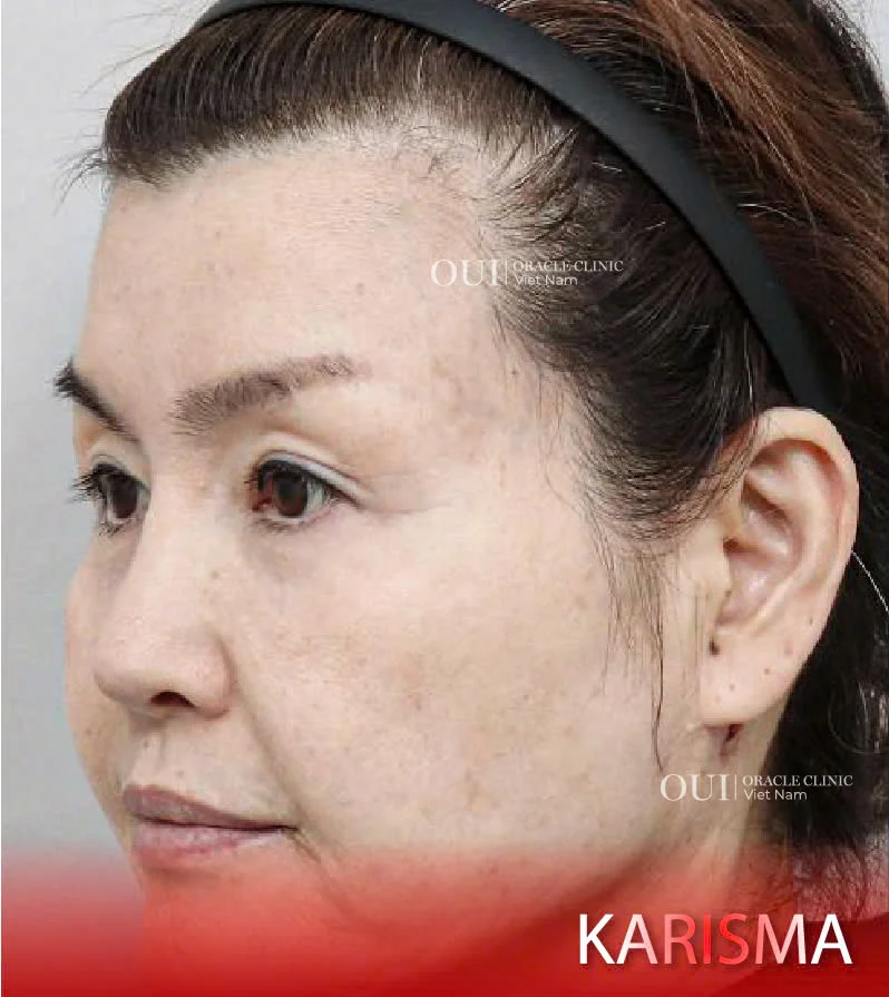 Hinh-anh-khach-hang-truoc-sau-15