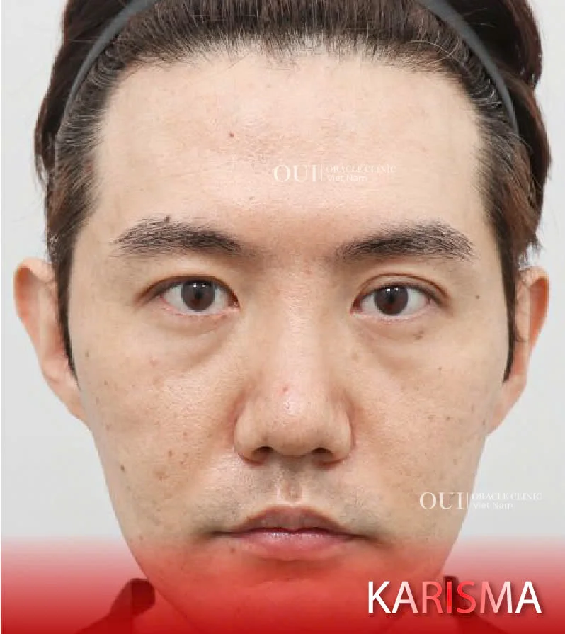 Hinh-anh-khach-hang-truoc-sau-13