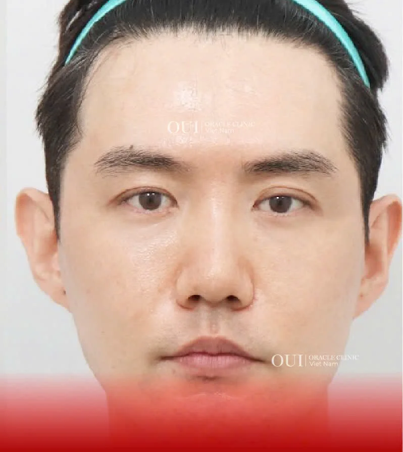 Hinh-anh-khach-hang-truoc-sau-14