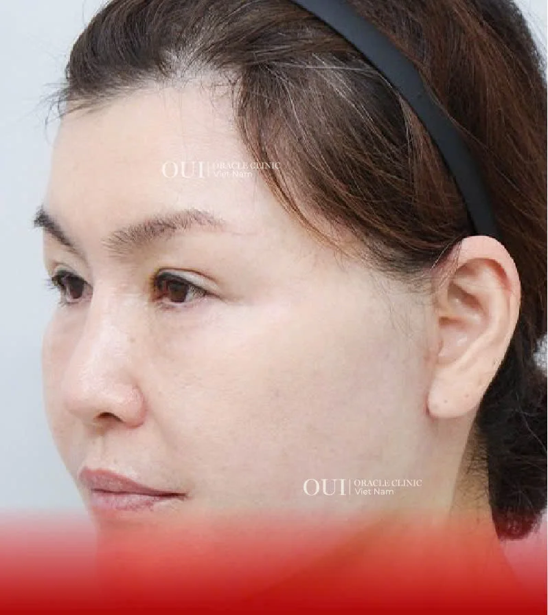 Hinh-anh-khach-hang-truoc-sau-16