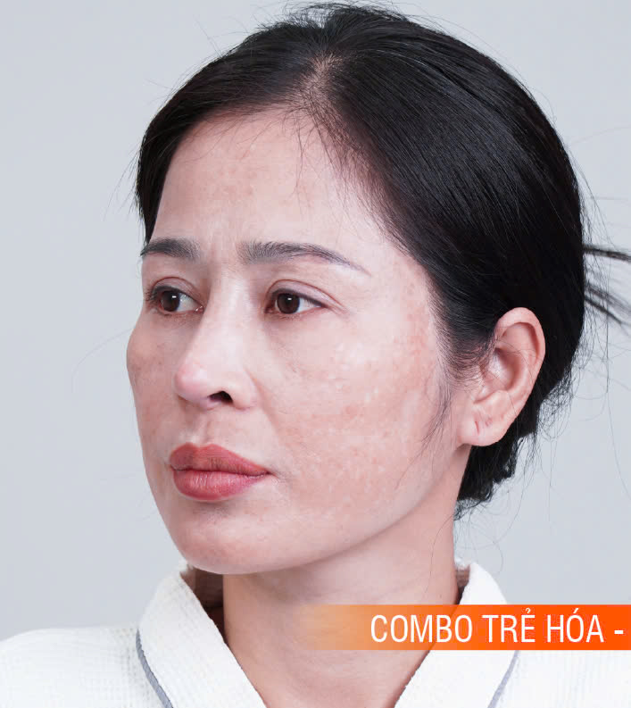 Hinh-anh-khach-hang-truoc-sau-3