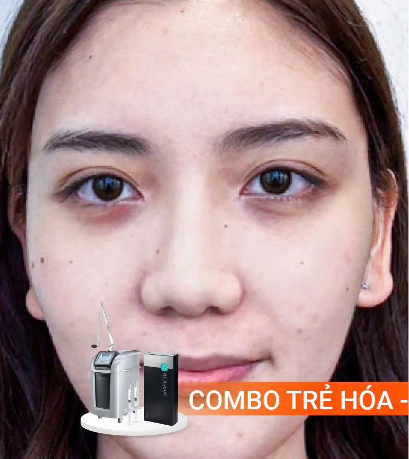 Hinh-anh-khach-hang-truoc-sau-11