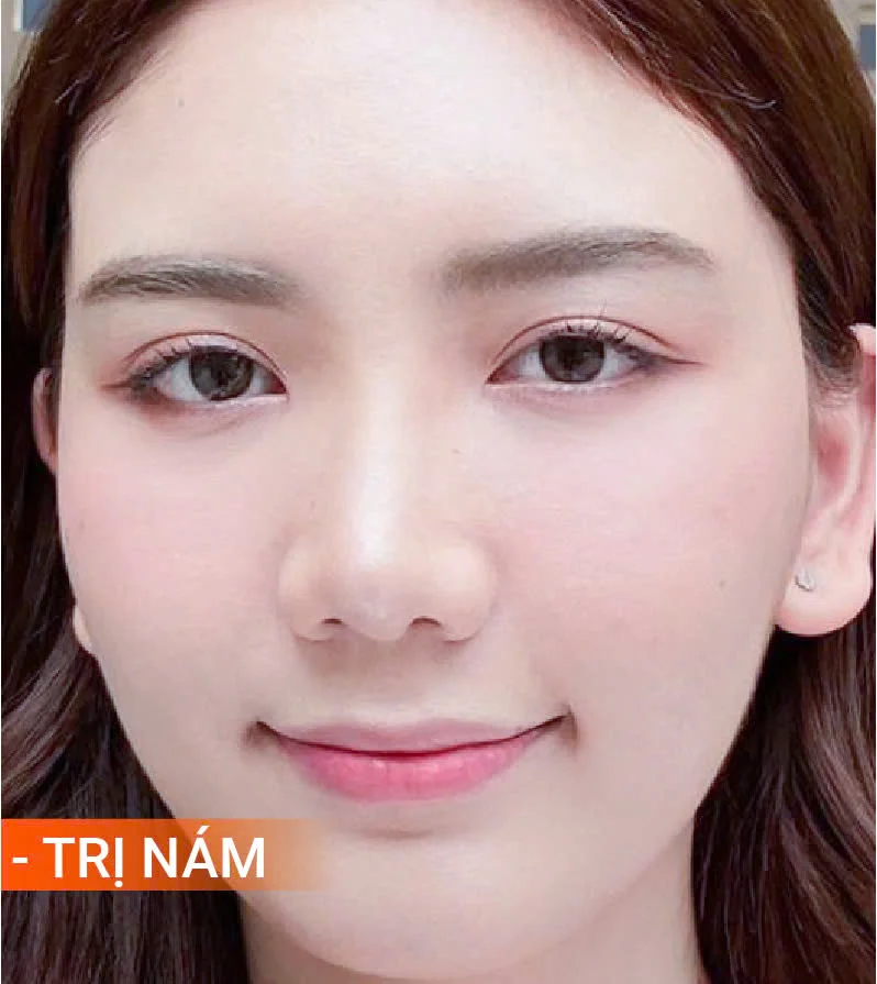 Hinh-anh-khach-hang-truoc-sau-12