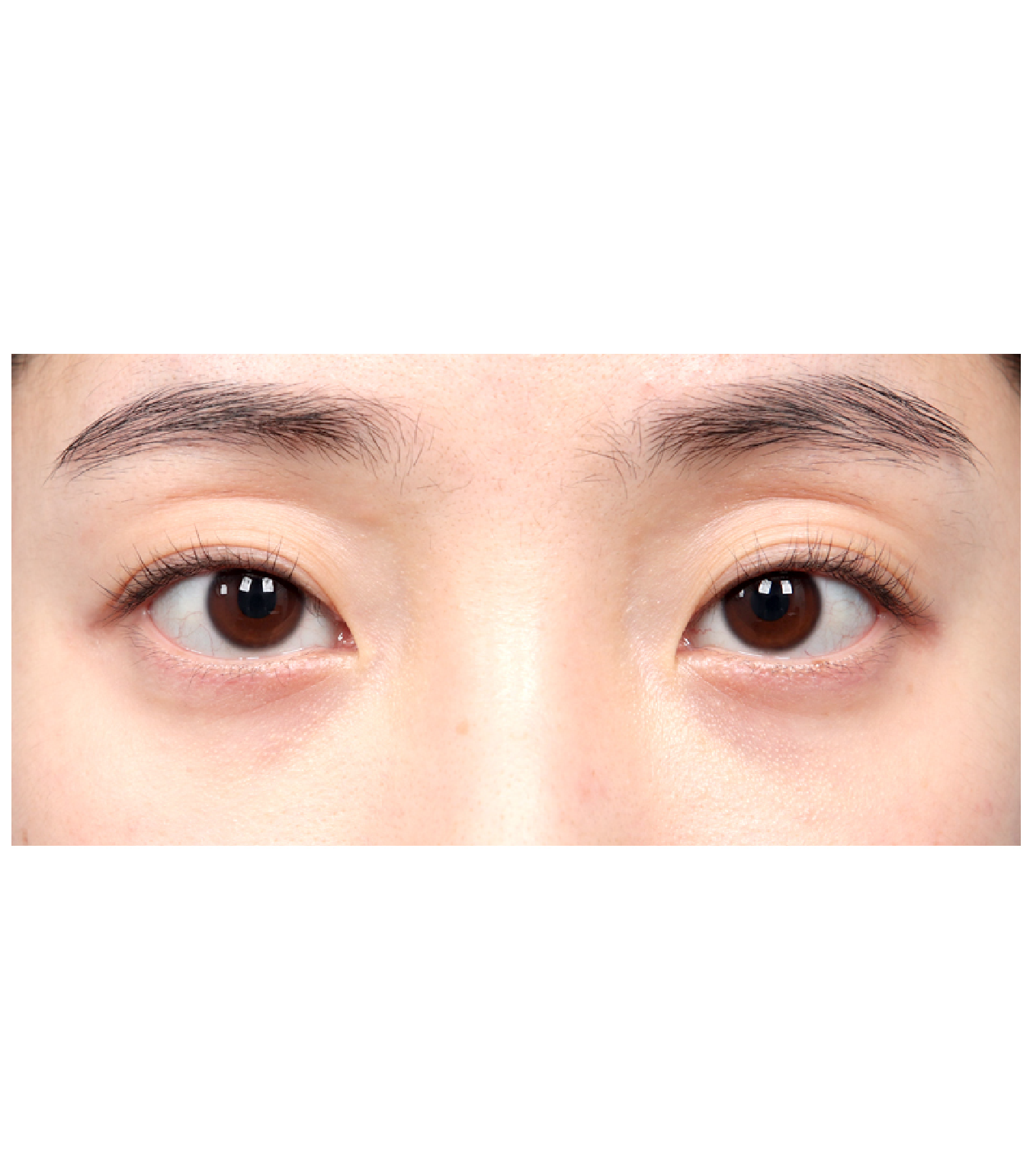 Hinh-anh-truoc-mat-nhieu-bong-mo