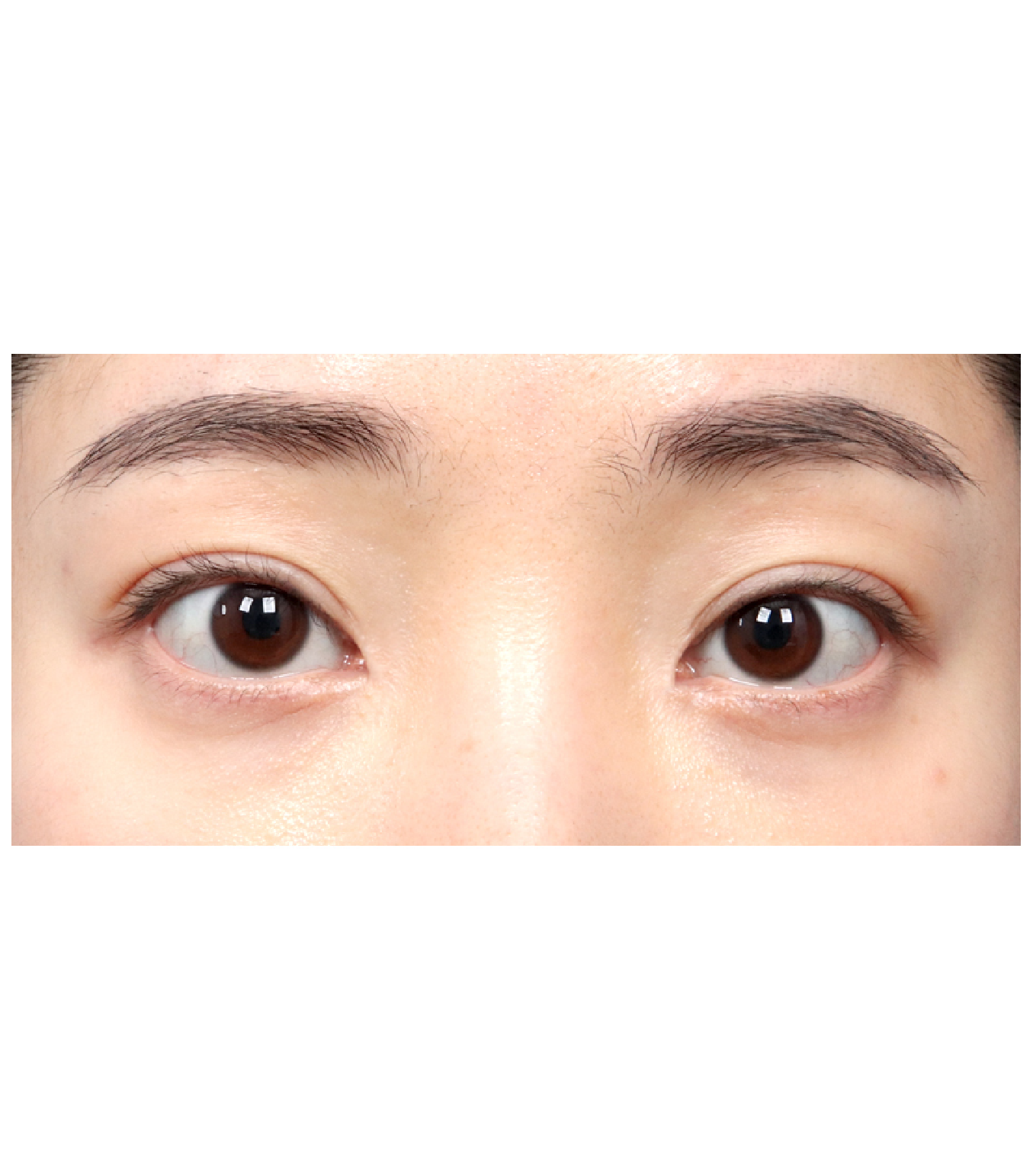 Hinh-anh-sau-mat-het-bong-mo