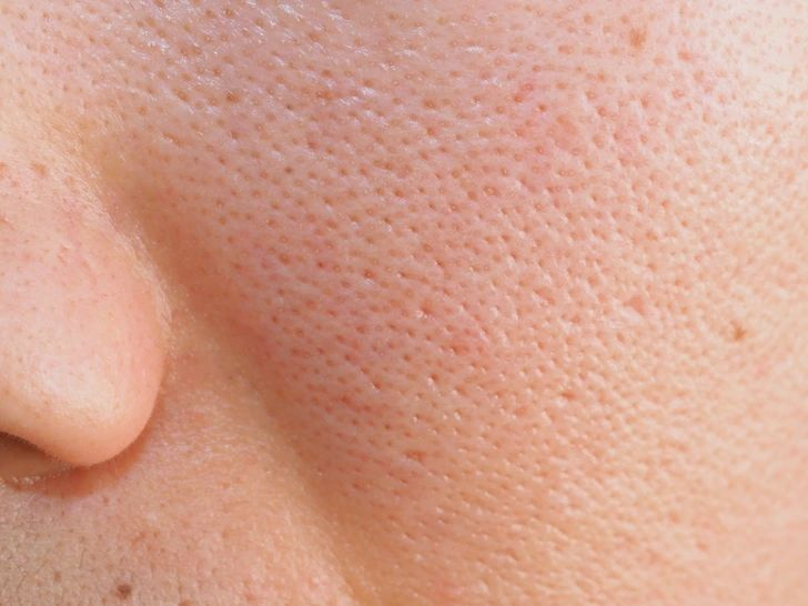 lao-hoa-da-sau-tuoi-30-5