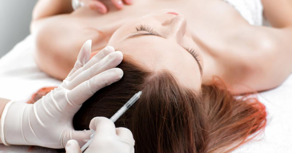 tiêm meso mọc tóc là gì