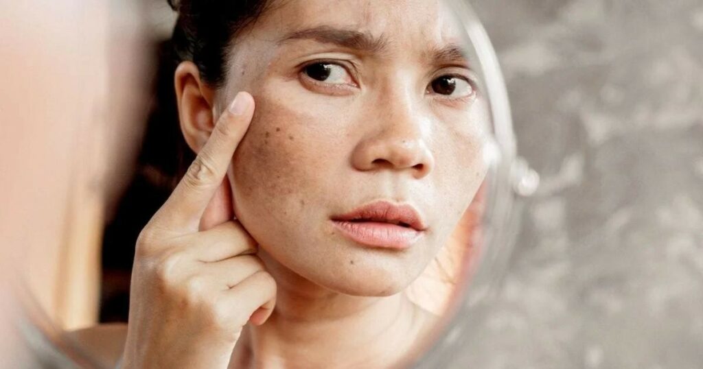 trẻ hóa da không nên bỏ lỡ thời điểm vàng