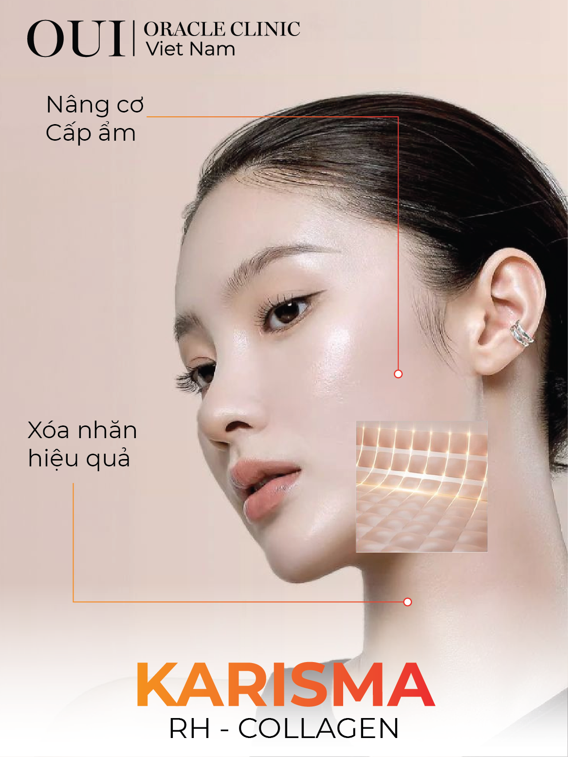 hiệu quả mang lại Karisma