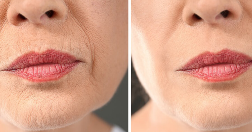 tại sao 30 tuổi có nên trẻ hóa