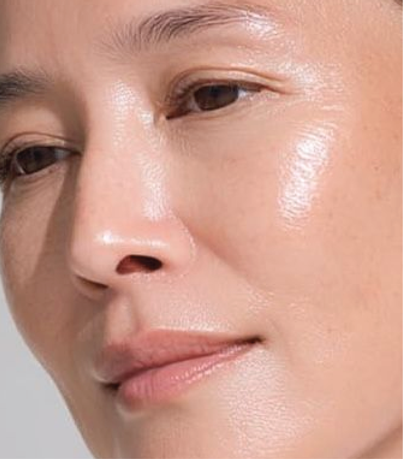 hình ảnh sau khi tiêm Karisma