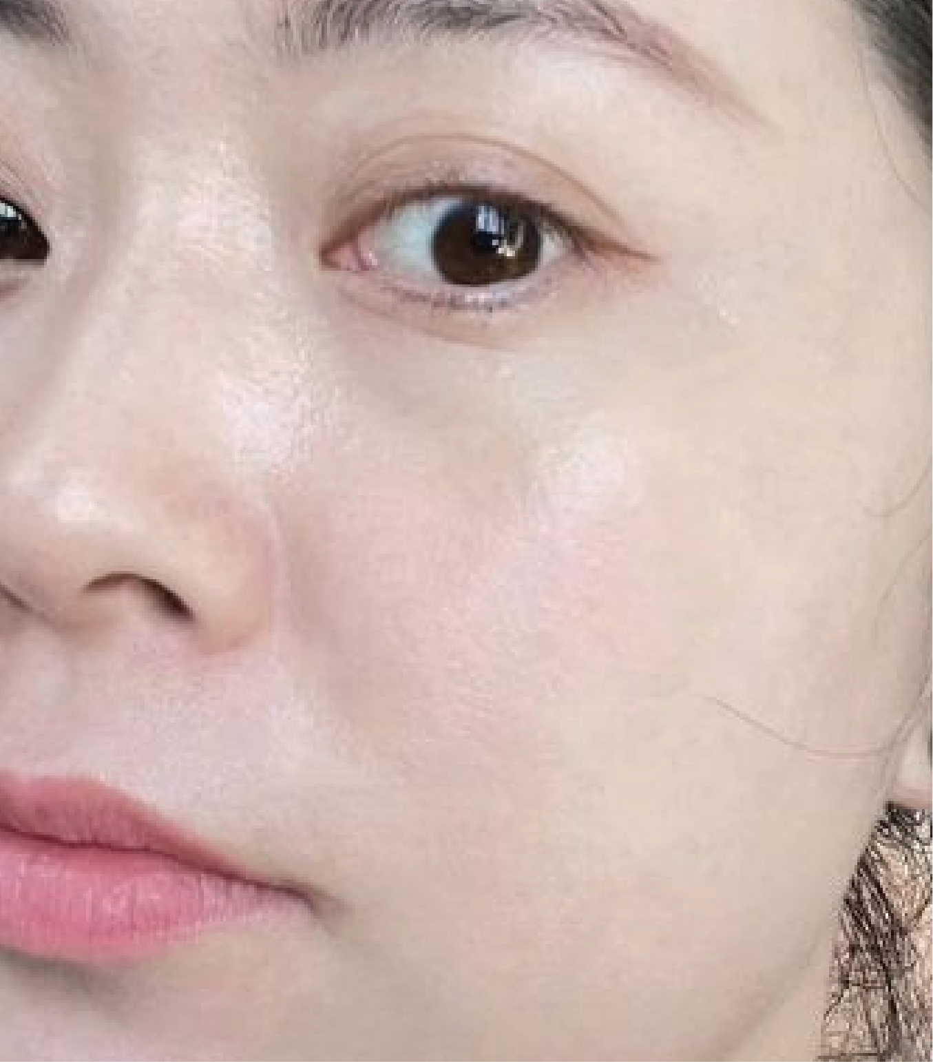 hình ảnh trước & sau khi thực hiện IPL