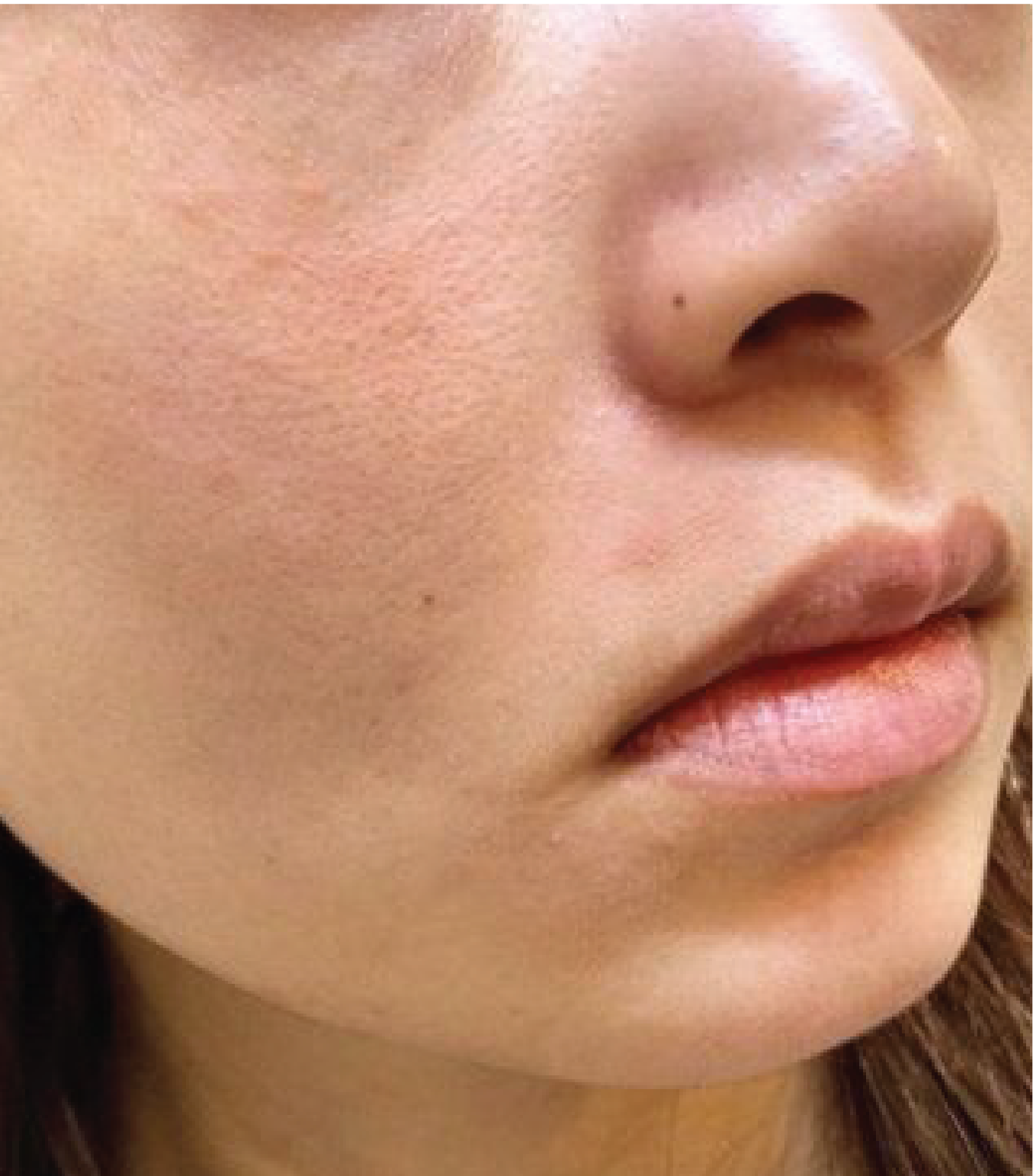 hình ảnh trước & sau khi thực hiện IPL