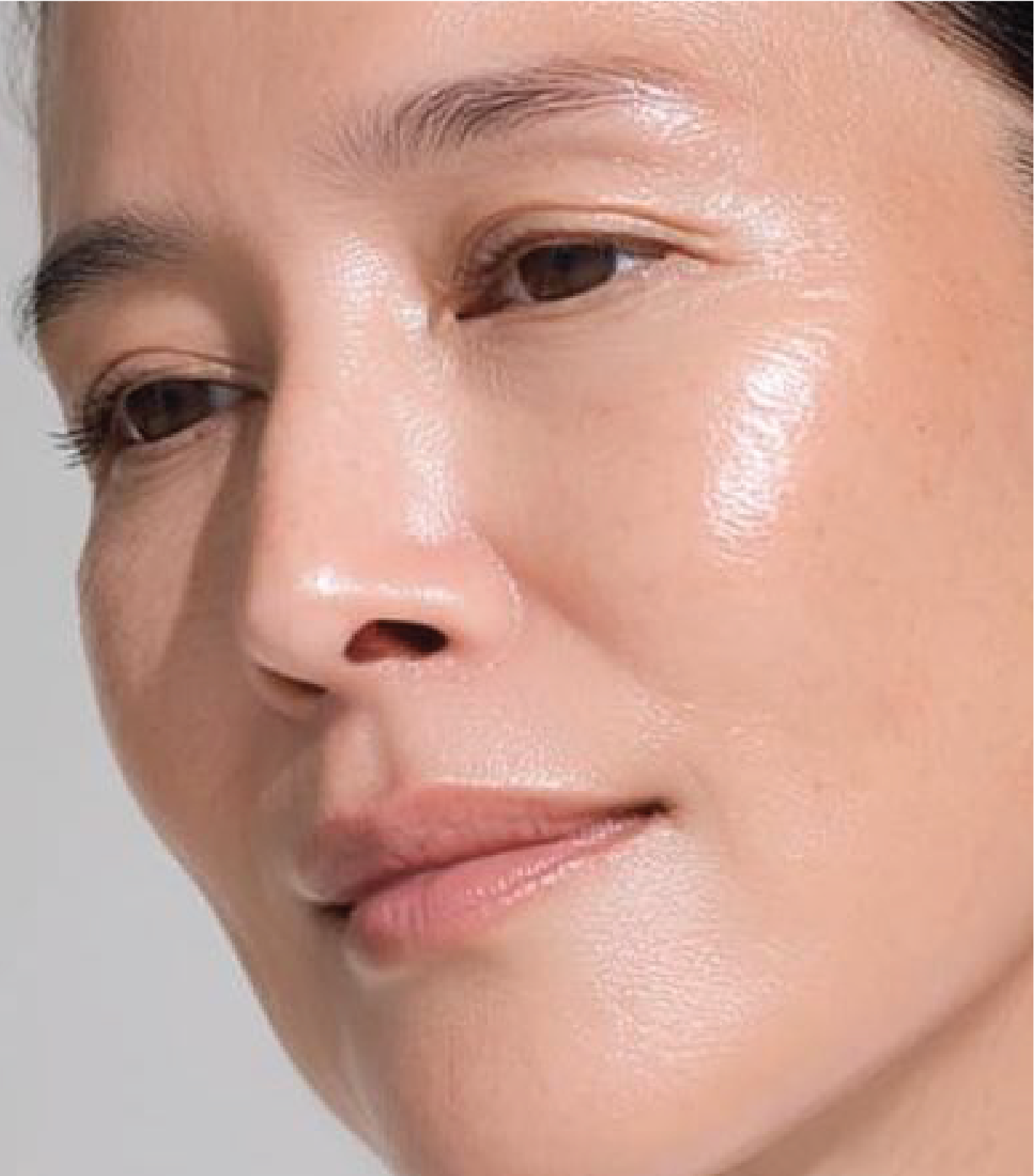 hình ảnh trước & sau khi thực hiện Meso Exocode