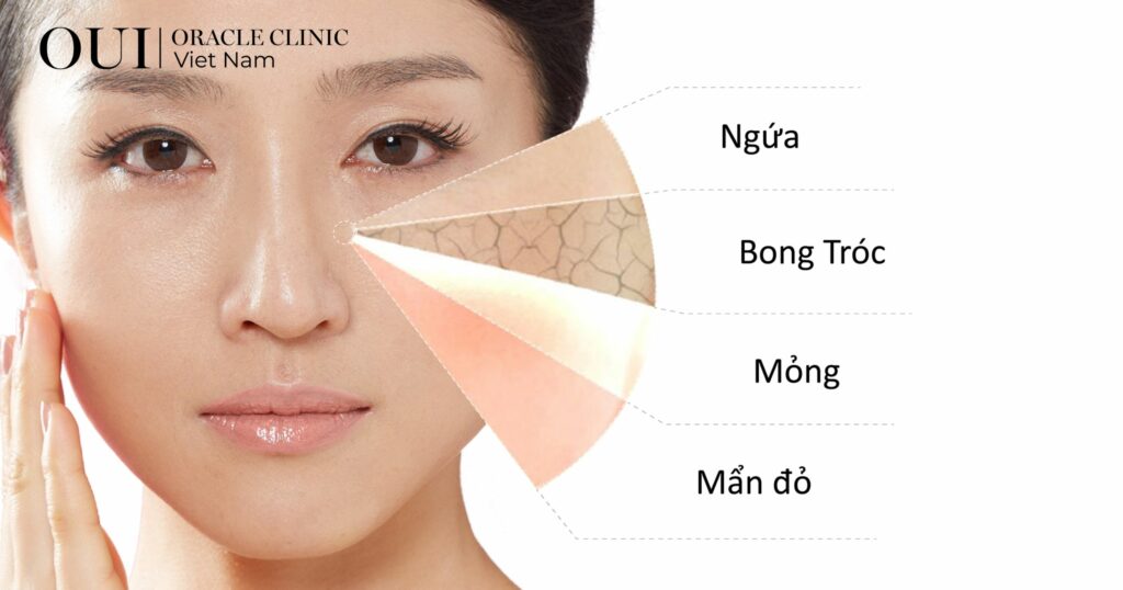 cách cấp ẩm cho da mùa hè da thiếu ẩm