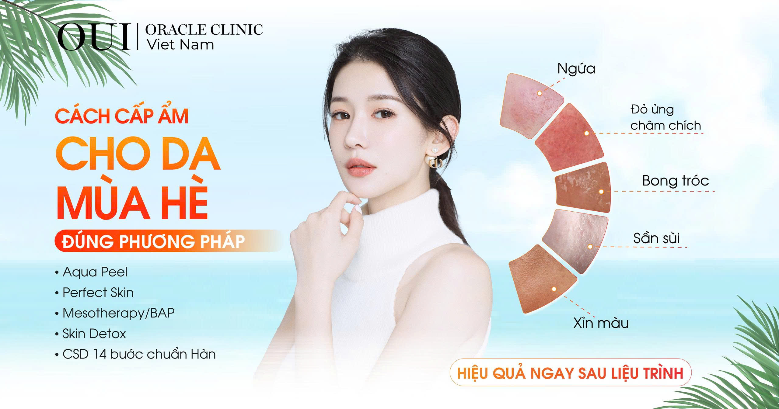 cách cấp ẩm cho da mùa hè