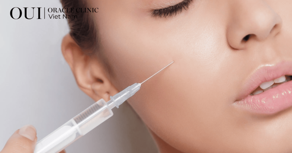 chống lão hóa mùa hè tiêm meso