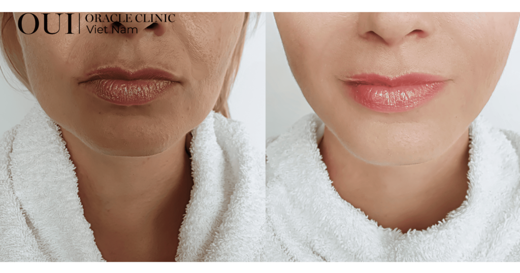 chống lão hóa mùa hè 7 mẹo chăm sóc da