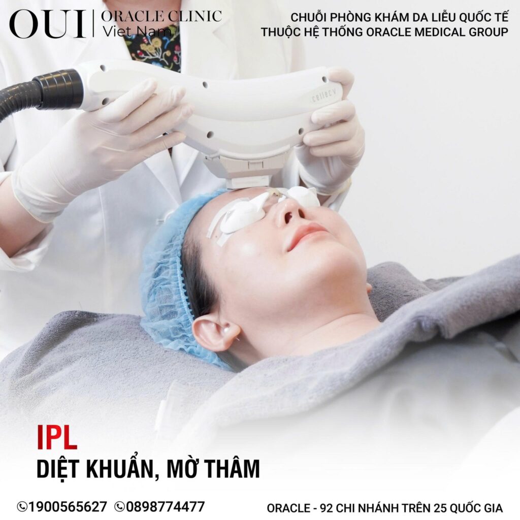 da bị sạm đen do nắng có hồi lại không công nghệ IPL