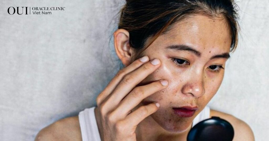 Da lão hóa do ánh nắng dấu hiệu nhận biết