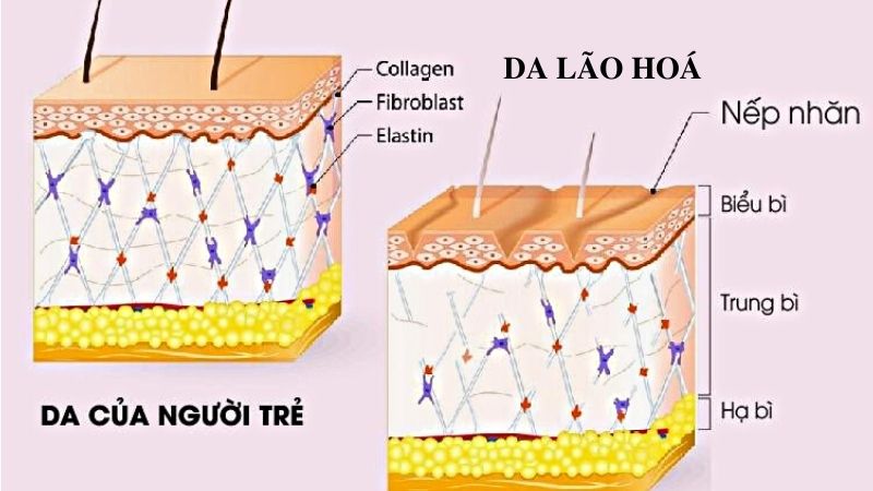 da mất đàn hồi suy giảm collagen và elastin
