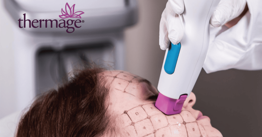 da mất đàn hồi cải thiện bằng thermage FLX