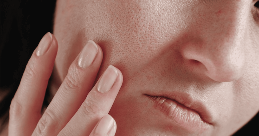 da mất đàn hồi lỗ chân lông to