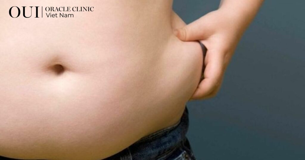 giảm mỡ bụng nhanh mỡ bụng là vùng khó giảm nhất