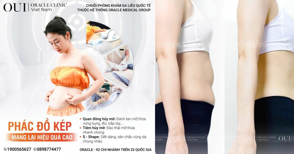 giảm bụng mỡ nhanh