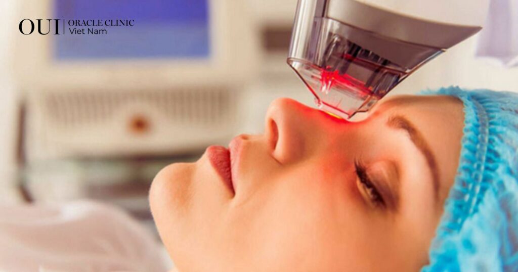 laser trị nám có bị bắt nắng không có an toàn không