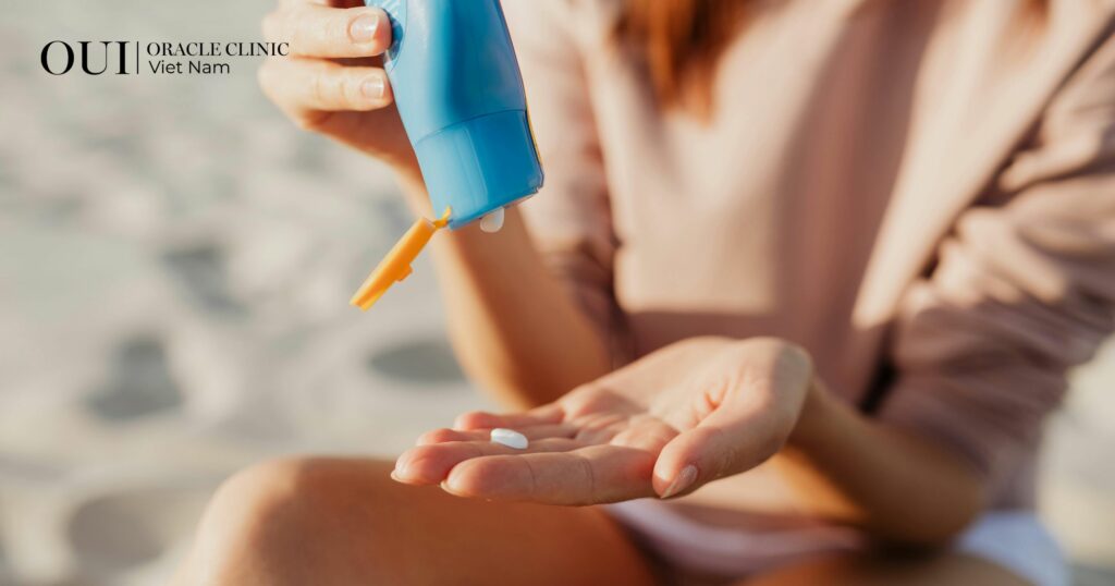 Laser trị nám có bị bắt nắng không chống nắng là chìa khóa