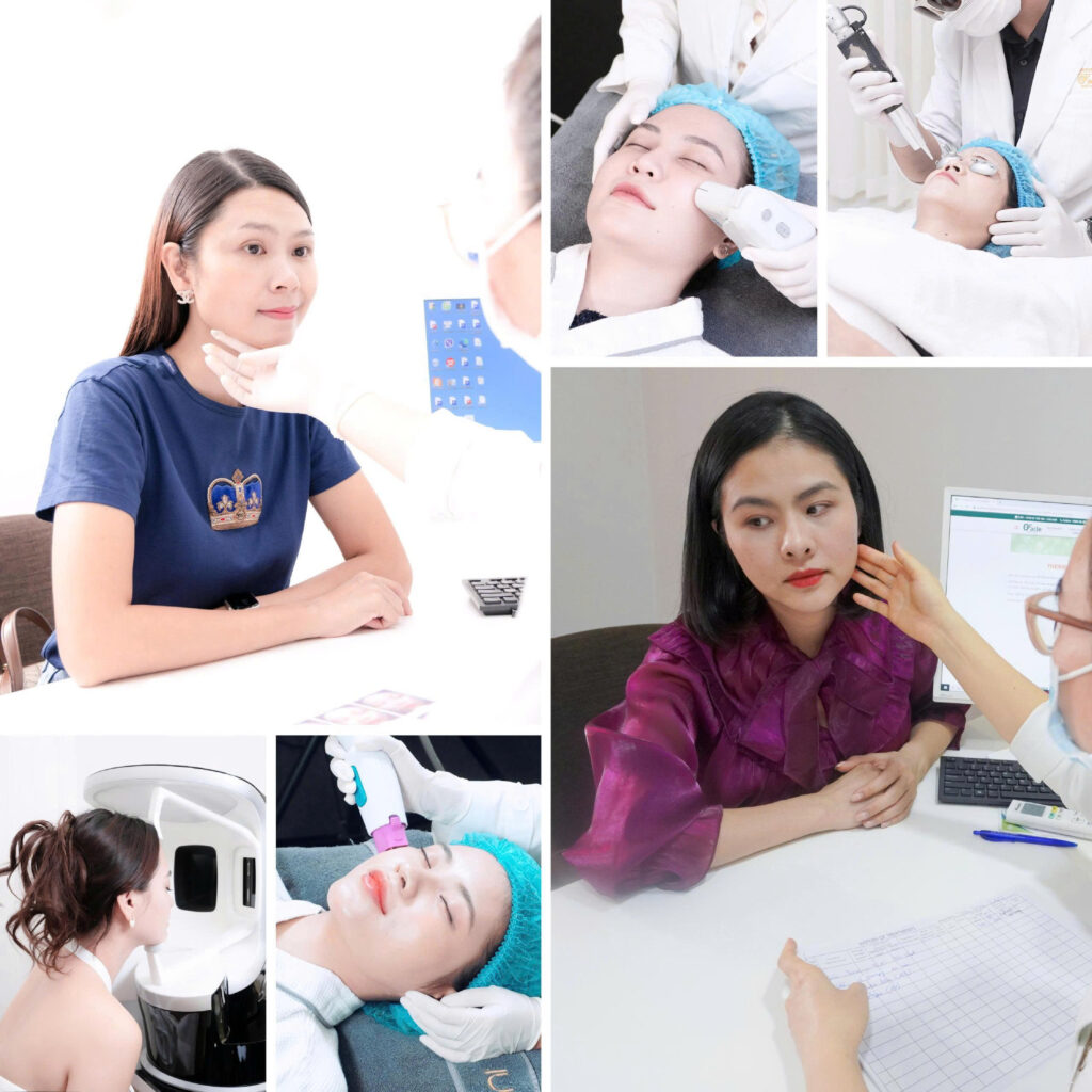 Thermage có bị hóp má không trải nghiệm thật của khách hàng