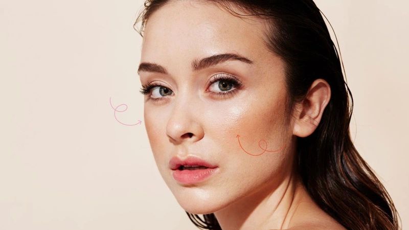 Thermage có bị hóp má không sai chỉ định điều trị