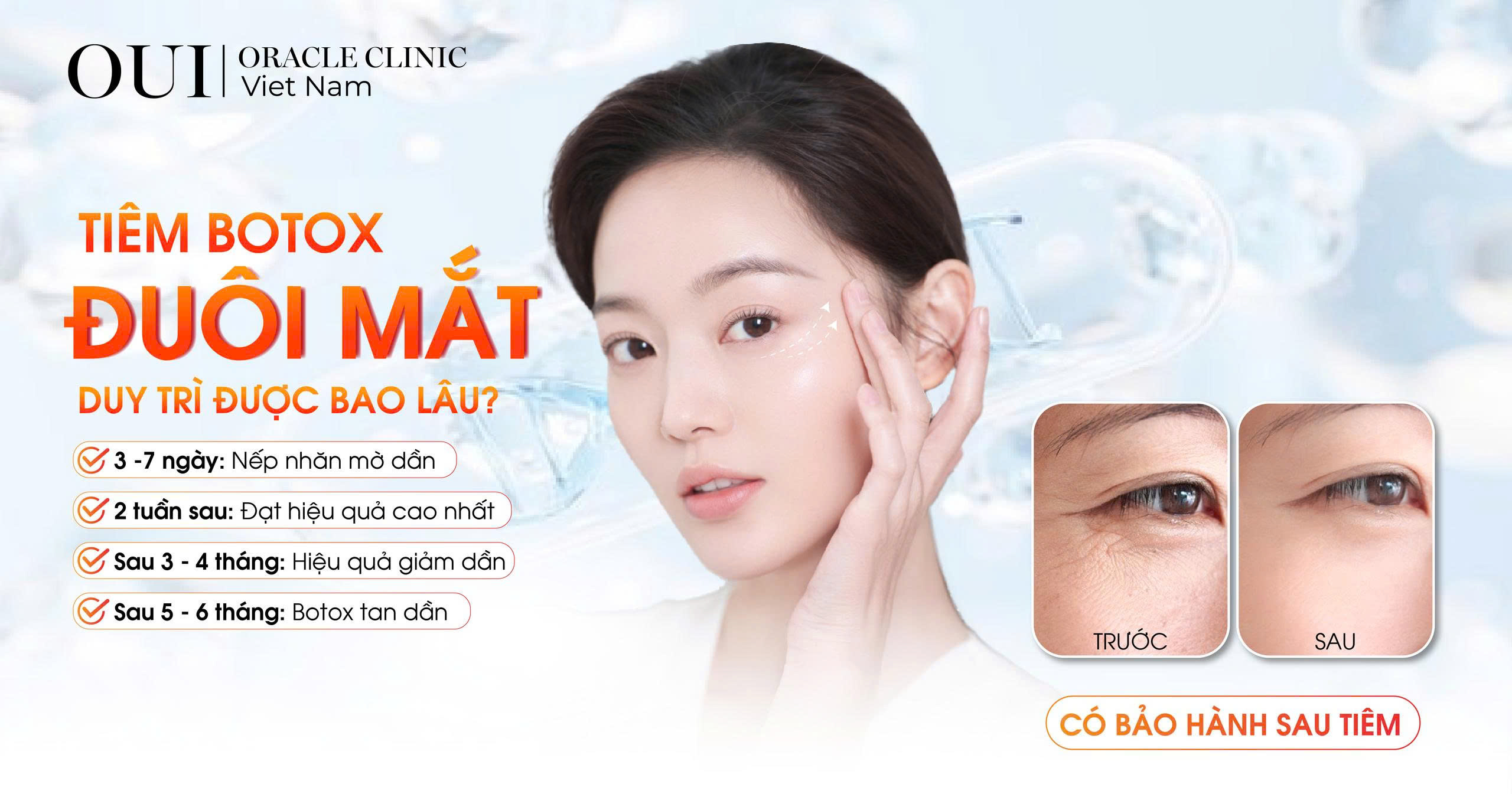 tiêm botox đuôi mắt duy trì được bao lâu