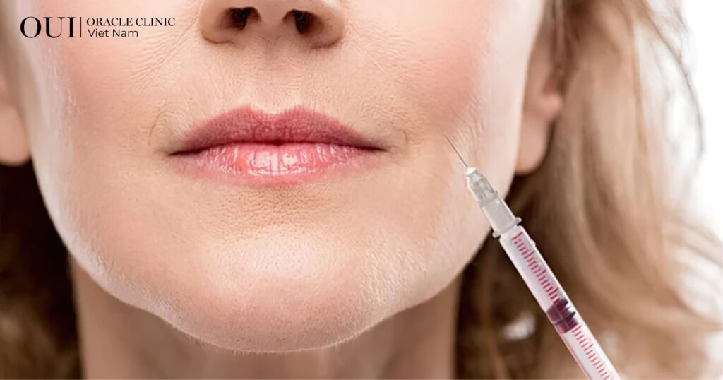 tiêm botox giữ được bao lâu có thời hạn