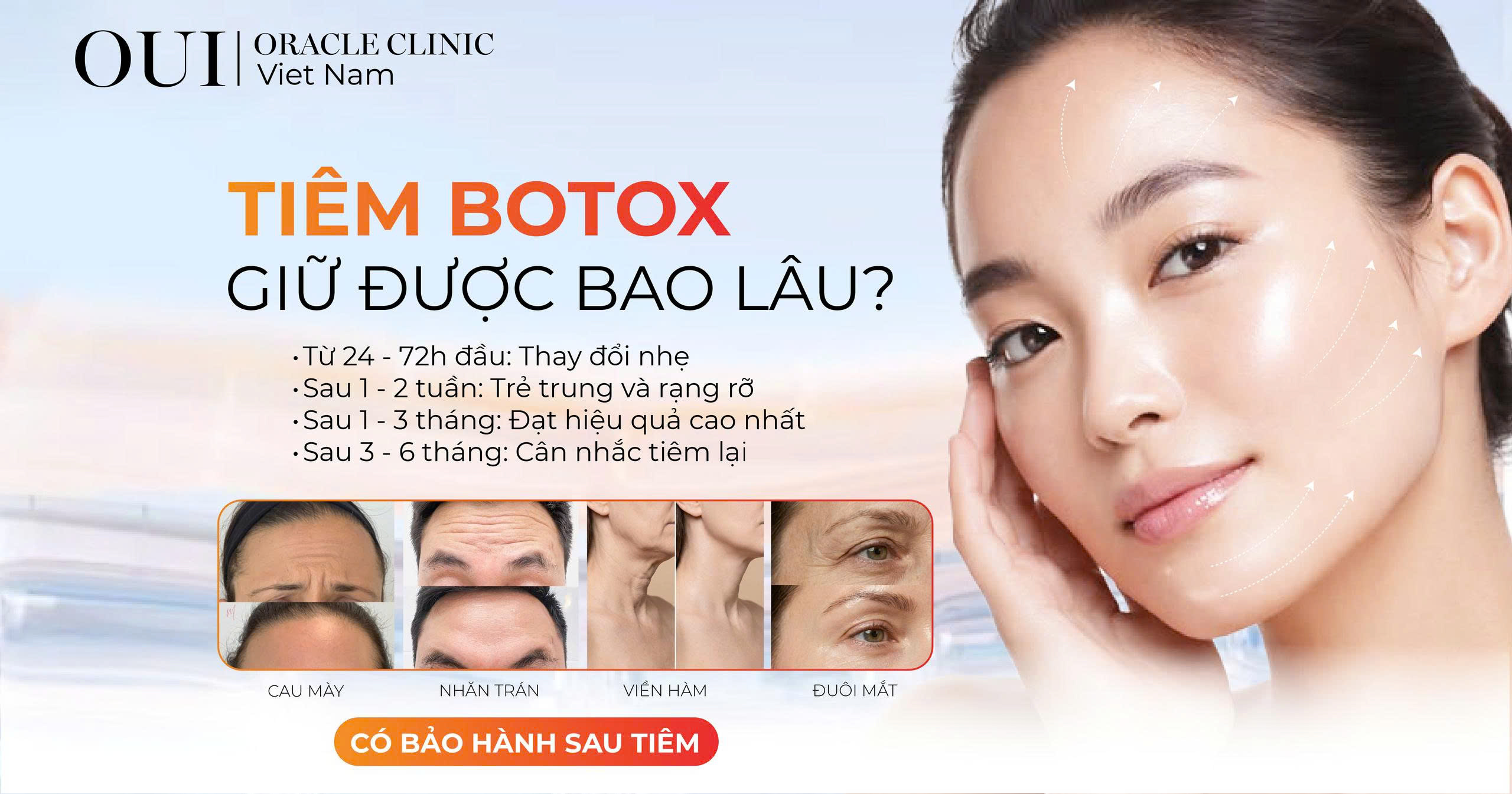 tiêm Botox giữ được bao lâu