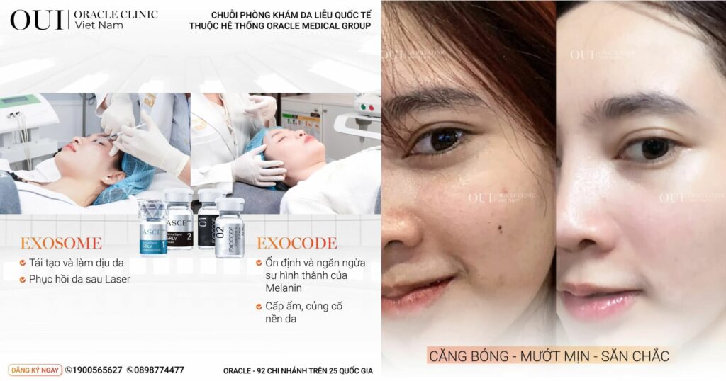 tiêm meso cấp ẩm exocode