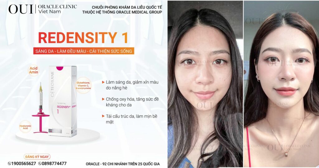 tiêm meso cấp ẩm redensity I